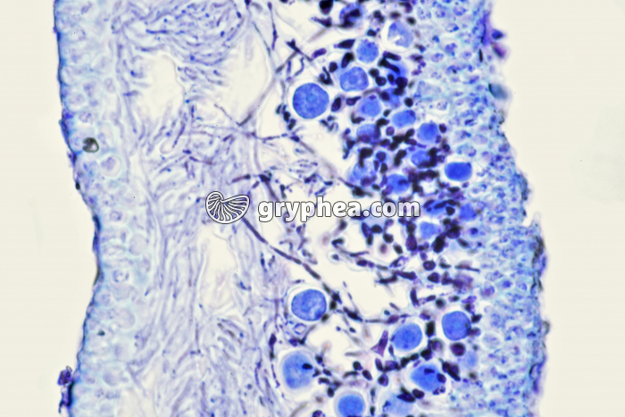 Lichen thalle CT x160 - gryphea.com